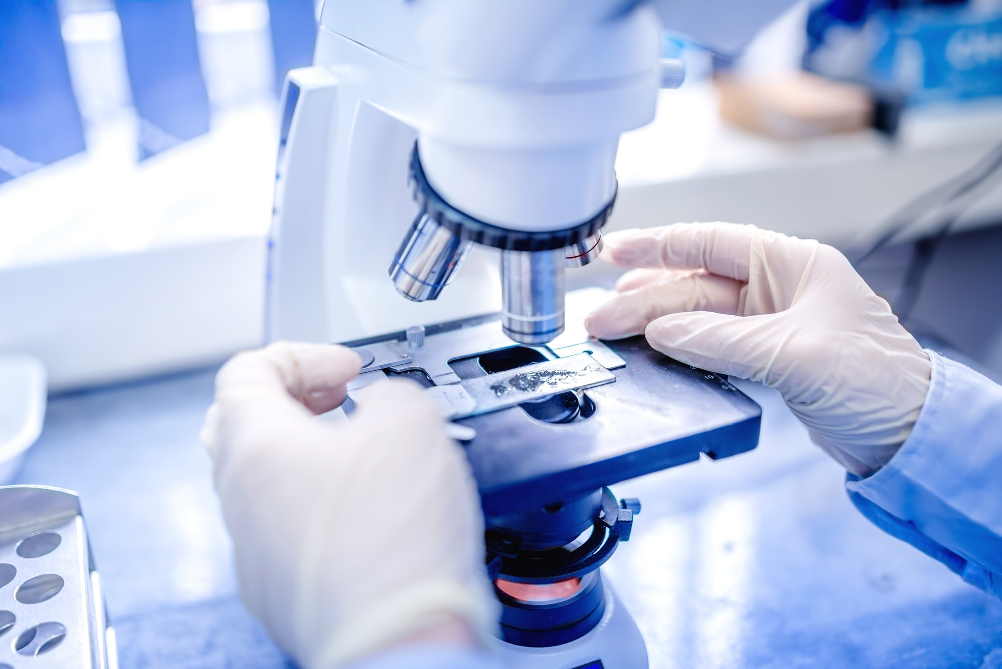 scientist hands with microscope, examining samples and liquid. Medical research